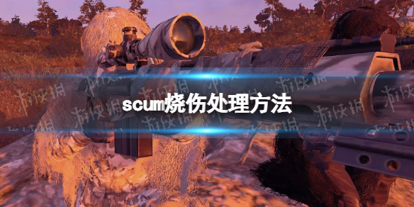 《人渣》烧伤了怎么办？ 烧伤处理方法