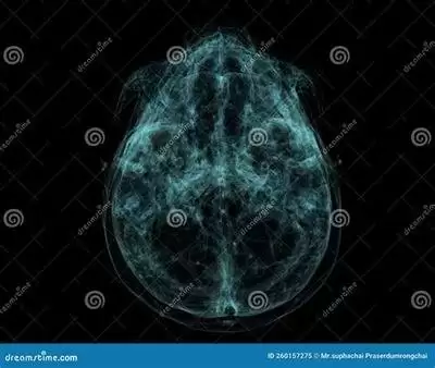 王者荣耀世界共鸣流技究竟指什么