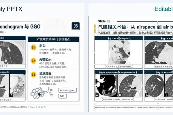 yixueAIganhuo-PPT 仓库截图展示界面或说明内容